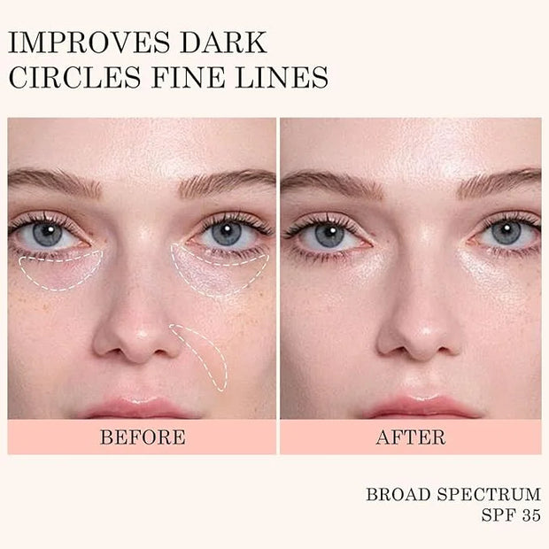 KYDA Mineral Sunscreen Eye Cream, 3-in-1 Anti-Aging Eye Cream, SPF 35, for Dark Circle and Fine Lines, Pink - Product Image