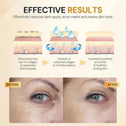 Under Eye Patches, 10 Pairs Gold Collagen Eye Gels Mask, Reduce Dark Circles, Wrinkles Puffy & Bags, Anti-aging Moisturizi...