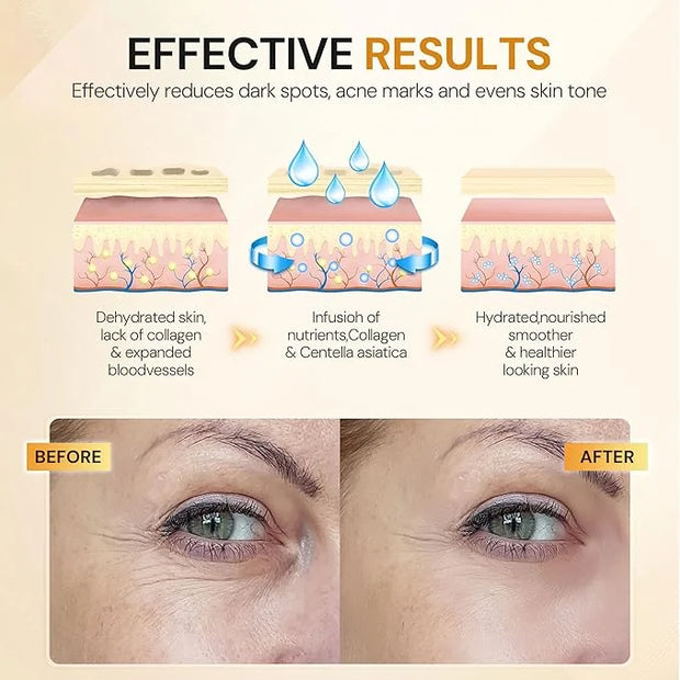 Under Eye Patches, 10 Pairs Gold Collagen Eye Gels Mask, Reduce Dark Circles, Wrinkles Puffy & Bags, Anti-aging Moisturizi...