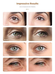 Under Eye Patches, 20 Pairs 24K Gold Eye Patches For Puffy Eyes, Under eye Bags, Wrinkles, Nourish Skin, Eye Masks With Co...