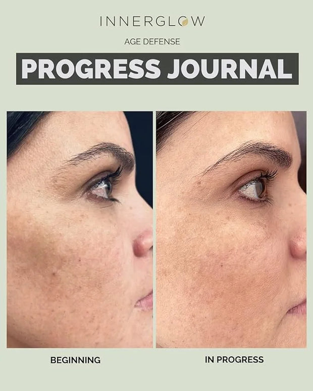 Inner Glow Age Defense Vitamins - Dermatologist and Plastic Surgeon Developed to Fight photoaging and Melasma, Polypodium ...