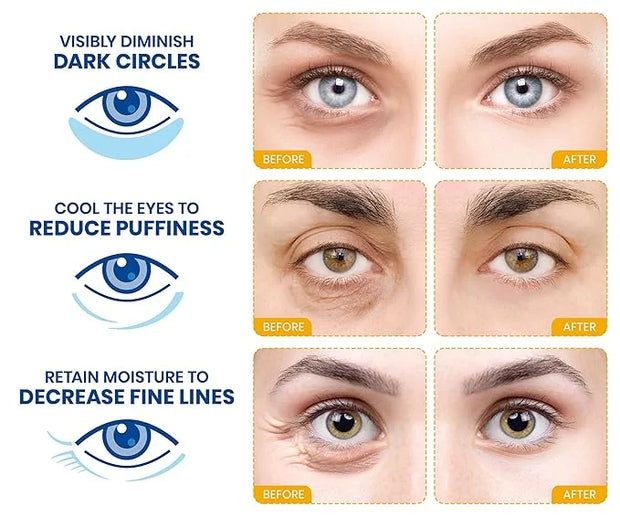 Stylia Under Eye Patches for Dark Circles and Puffy Eyes (15 Pairs) - 24k Gold Collagen Mask with Hyaluronic Acid, Eye Mas...