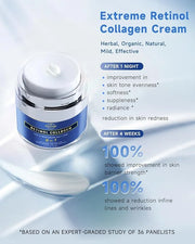 Retinol Cream for Face, Face Moisturizer with Collagen & Hyaluronic Acid, Anti Aging Neck Cream for Tightening Skin, Facia...