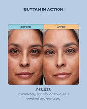 Buttah Skin Awakening Eye Cream for Dark Circles and Puffiness - Anti Aging Eye Care Cream - Eye Cream For Wrinkles - Nour...