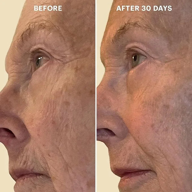 Glo Skin Beauty Bio-Renew EGF Eye Cream - Epidermal Growth Factor Cell Repairing Eye Cream, Combats Signs of Aging By Repa...