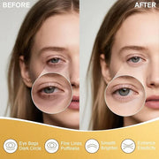 Under Eye Patches for Puffy Eyes and Dark Circles, 20 Pairs Eye Mask with Hyaluronic Acid & Collagen, Anti Wrinkle Patches...