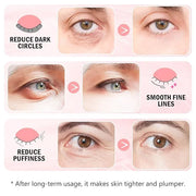 Under Eye Patches (30 Pairs) - 24K Gold Eye Mask for Puffy Eyes, Dark Circles, Under Eye Bags and Smooth Wrinkles, Eye Gel...