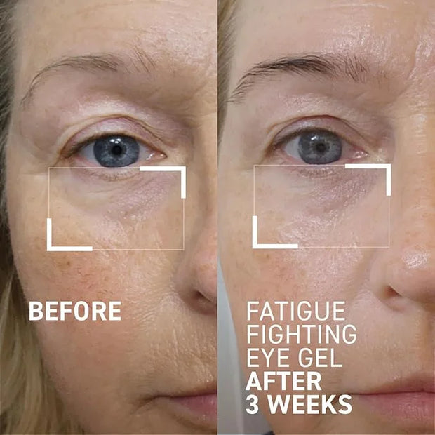 Dr. Brandt iD-STRESS Fatigue Fighting Eye Gel - 0.5 fl oz, Pack of 2 - Rapidly Diminishes Signs of Dryness, Fatigue & Dark...