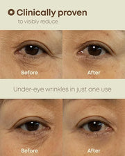 Ever-Youth Dual Effect Eye Cream Korean Skincare Instant Lifting Technology for Firm Eyes with Niacinamide Adenosine Hyalu...