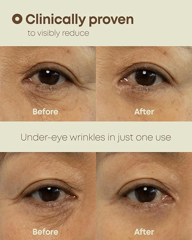 Ever-Youth Dual Effect Eye Cream Korean Skincare Instant Lifting Technology for Firm Eyes with Niacinamide Adenosine Hyalu...