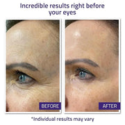 YEOUTH Instant Face Lift Cream, Temporary Skin Tightening Under Eye Cream for Women, Tightening and Lifting Concealer 15ml...