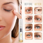 Instant Eye Cream Duo – Lightweight Formula for Hydrating & Refreshing Under-Eye Area, Reducing the Appearance of Puffines...