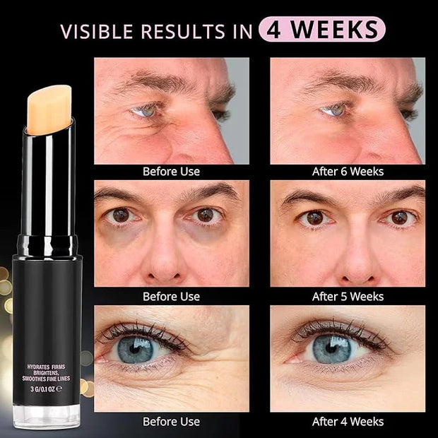 VELAMO ADVANCED Retinol Eye Stick: Retinol Eye Cream for Dark Circles and Puffiness with 1% Bakuchiol and Caffeine - Visib...