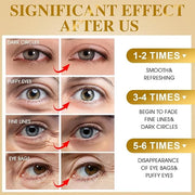 VESPRO 120 PCS 24K Gold Under Eye Patches for Dark Circles and Puffy Eyes, Eye Mask With Collagen and Hyaluronic Acid for ...