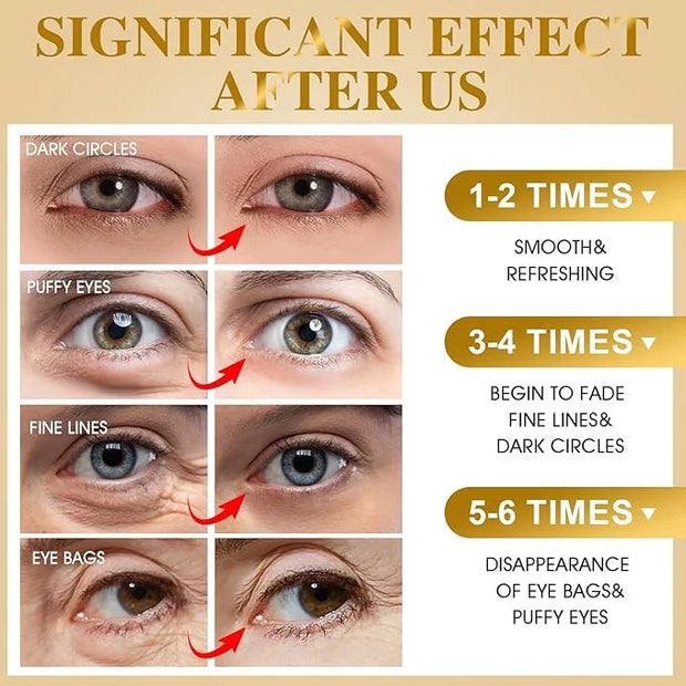 VESPRO 120 PCS 24K Gold Under Eye Patches for Dark Circles and Puffy Eyes, Eye Mask With Collagen and Hyaluronic Acid for ...