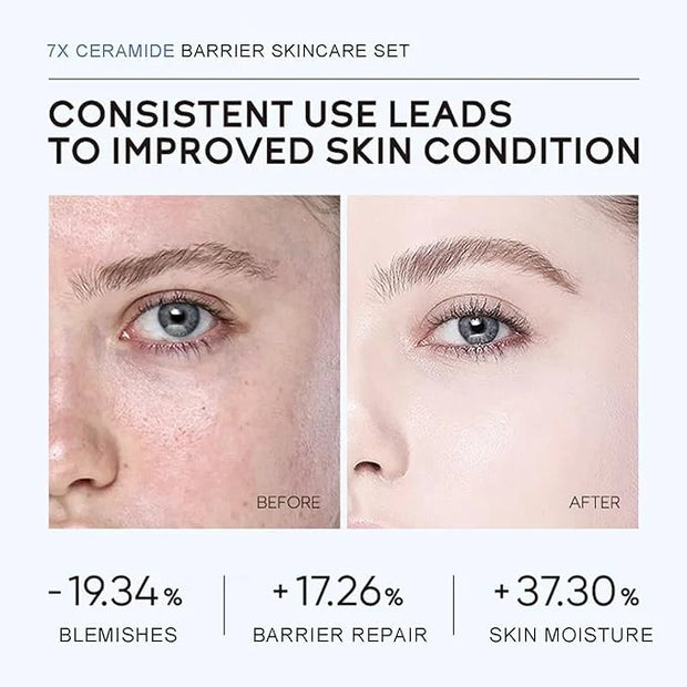 Skincare Set Ceramide Skincare Gifts for Teen Girls Strengthen Skin Barrier, Beauty Gift Sets Skin Care Kits, Travel Essen...