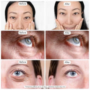 Instant Under Eye Bag Remover – Anti-Aging Under Eye Cream for Dark Circles and Puffiness - Rapid Eye & Face Lift – No Fla...
