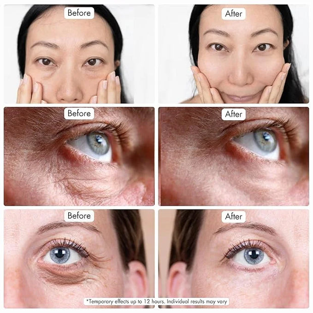 Instant Under Eye Bag Remover – Anti-Aging Under Eye Cream for Dark Circles and Puffiness - Rapid Eye & Face Lift – No Fla...