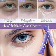 Retinol Eye Cream, Moisturizing Eye Care Daily Anti-Wrinkle Cream with 45% Retinol and 5% Hyaluronic Acid to Smooth and Mo...