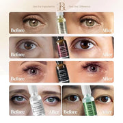 Decoder Firming and Rejuvenating Beauty Eye Serum Oil, Eye Skin Care Essence Oil, Under Eye Cream - Jojoba Oil, Squalane, ...