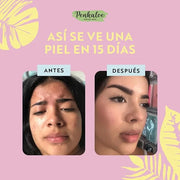 Penkaloe Aloe Skincare Kit | Cuidado Natural para la Piel, Control de Grasa y Mejora de la Apariencia | Aloe Skincare Rout...