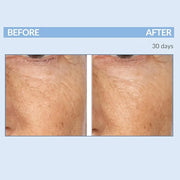 Serious Skincare - Retinol Vitamin A Eye XR Under Eye Cream Concentrate - Reduce Fine Lines, Dark Circles & Puffiness - Da...