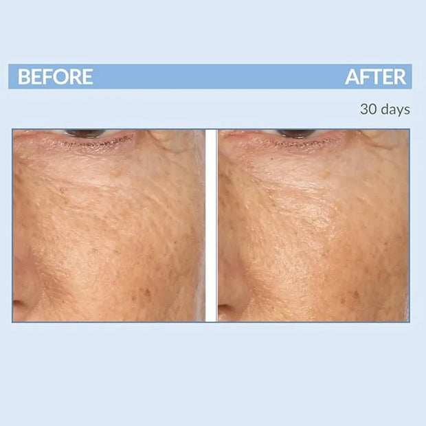 Serious Skincare - Retinol Vitamin A Eye XR Under Eye Cream Concentrate - Reduce Fine Lines, Dark Circles & Puffiness - Da...