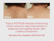ATOPALM | Intensive Moisturizing Cream | Face & Body Moisturizer | For Dry & Sensitive Skin | Paraben-Free Lotion | Replen...