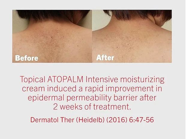 ATOPALM | Intensive Moisturizing Cream | Face & Body Moisturizer | For Dry & Sensitive Skin | Paraben-Free Lotion | Replen...