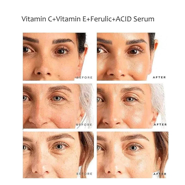 Vitamin C Face Serum Vitamin CE Serum with Ferulic Acid for Women Vitamin E and Ferulic Serum Skin Care - Vitamin C Serum ...