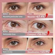 Novoy 7 Pairs Bio-Collagen Real Deep Eye Patches - 6-in-1 Retinol Overnight Eye Patches for Dark Circles, Puffiness & Wrin...