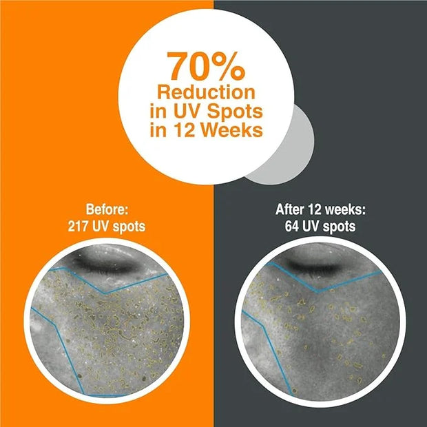 PHOTOZYME iQuad Total Eye Therapy with DNA Repair Enzymes | Anti Aging Eye Cream | Use to Reduce Bags, Dark Circles, Puffi...