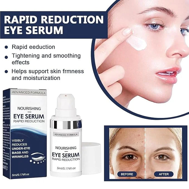 Rapid Reduction Eye Serum - Advanced Formula - Anti Aging Serum Visibly Reduces Under-Eye Bags - Product Image