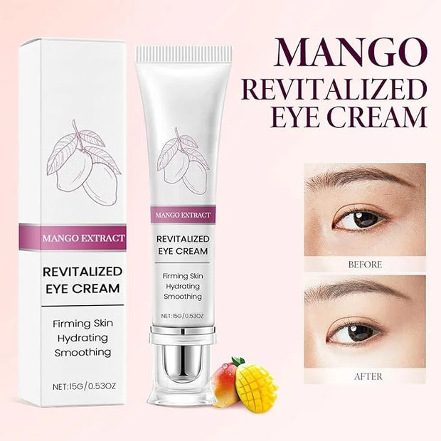 2PCS Mango Eye Cream, Eye Moisturizing Serum, Anti-Aging Treatment for Puffiness, Dark Circles & Fine Lines, Fast-Absorbin...