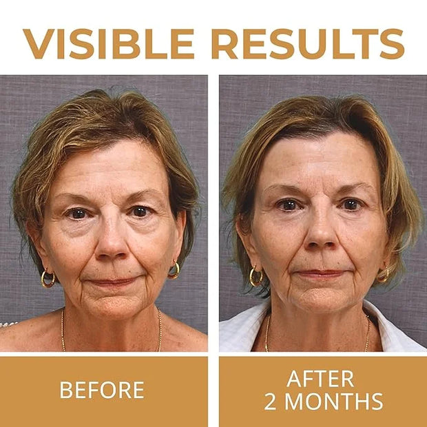 ABERA Natural Repair Eye Cream with Set 15 Eye Masks, Minimizes Under Eye Bags & Dark Circles, Reduce Puffiness, Wrinkles ...