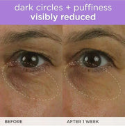 TATCHA The Brightening Eye Cream | Brightening & Dark Circle Reduction with Vitamin C for Bight, Firm Undereyes, 15 ml / 0...