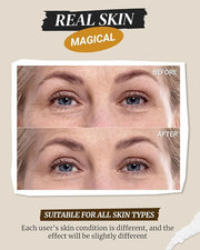 Hydrating Firming Under Eye Cream, Anti Aging Formula for Minimizes Fine Lines, DarkCircles and Puffiness, Cactus and Yeas...