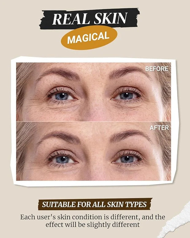 Hydrating Firming Under Eye Cream, Anti Aging Formula for Minimizes Fine Lines, DarkCircles and Puffiness, Cactus and Yeas...