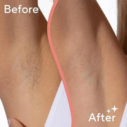 Finishing Touch Flawless Underarm Hair Removal Electric Razor Device, Designed to Shave and Contour Womens Sensitive Under...