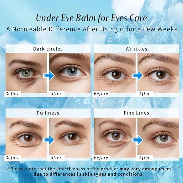 Eye Balm for Dark Circles: Cooling Eye Cream Under Eye Treatment, Cool Eye Stick Reduce Wrinkle & Puffiness, Hydrating Bal...