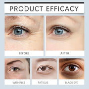 Anti Aging Wrinkle Remover For Face, Reduce Immediately Fade Fine Lines Around The Eyes, Eye Bags Firming Eye Cream Eye Es...
