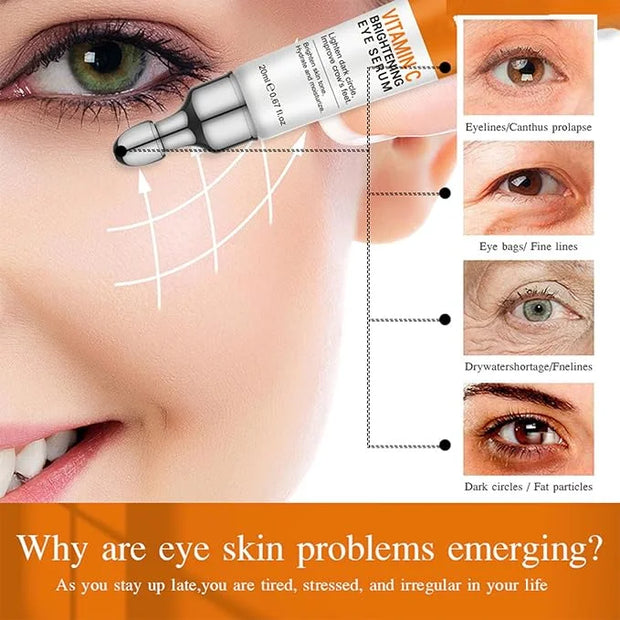 Vitamin C Eye Cream for Dark Circles, Fine Lines Puffiness Crow's Feet Eye Bags Under Eyes Treatment for Women & Men, Adva...