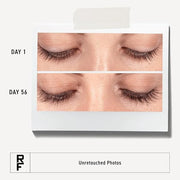 Rodan + Fields R+F Lash Boost Serum | 5 ml | Supports Fuller, Longer-Looking Eyelashes & Brows | Easy Nightly Application ...