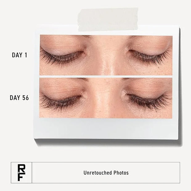 Rodan + Fields R+F Lash Boost Serum | 5 ml | Supports Fuller, Longer-Looking Eyelashes & Brows | Easy Nightly Application ...