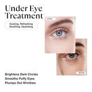 MATKAS Retinol Renewal Gold Under Eye Mask - 20 Pairs, Best Eye Patches for Puffy Eyes and Dark Circles, Collagen Under Ey...