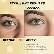 Under Eye Patches - 24 Pairs Gold Under Eye Mask for Puffy Eyes, Dark Circles, Eye Bags, Wrinkles, Collagen Eye Gels with ...