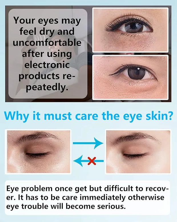 Under Eye Patches (60Pcs) - Upgraded Eye Mask Hyaluronic Acid & Collagen,Eye Treatment Mask,Under Eye Bag Treatment,Eye Ma...