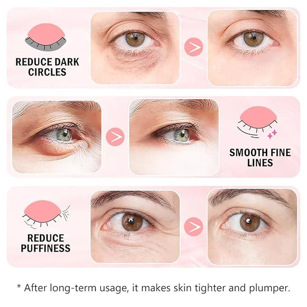 Under Eye Patches (30 Pairs) Hyaluronic Acid Eye Masks for Puffy Eyes, Dark Circles, Eye Bag, Wrinkles - Skin Care Gifts f...