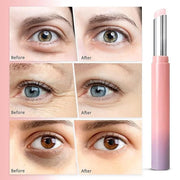 Eye Cream for Dark Circles & Puffiness: Instant Eye Bag Remover Puffiness Treatment, Retinol Eye Stick Bag Blam for Anti A...