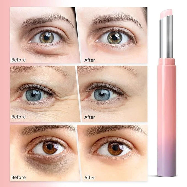 Eye Cream for Dark Circles & Puffiness: Instant Eye Bag Remover Puffiness Treatment, Retinol Eye Stick Bag Blam for Anti A...